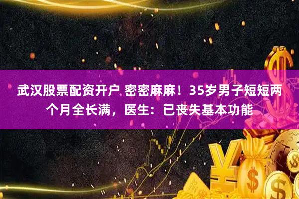 武汉股票配资开户 密密麻麻！35岁男子短短两个月全长满，医生：已丧失基本功能